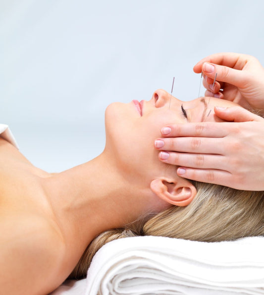 Facial Rejuvenation Acupuncture