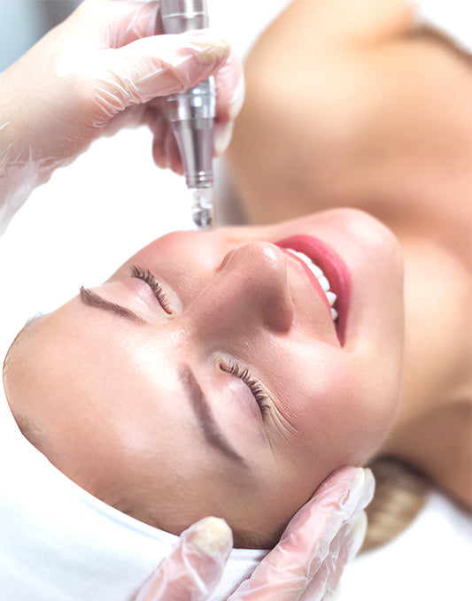 Micro-needling for Rejuvenation and Acne Scars